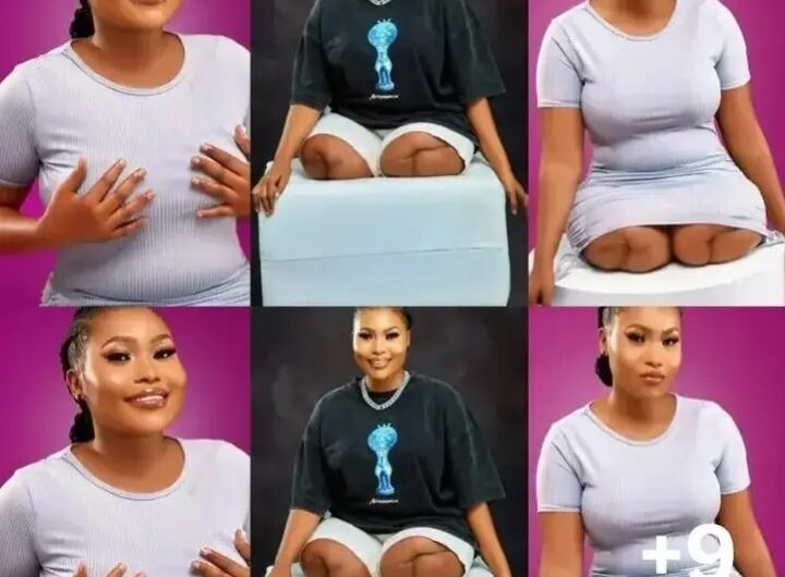 Only Wicked Will Skip Beautiful Lady With No Legs Dazzles As She Celebrates Her Birthday (Photos)